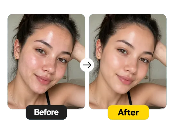 Usecase 1 Before After Selfie Clear Skin