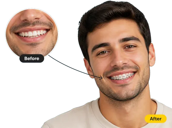 Usecase 1 Man Metal Braces Preview Before Consultation